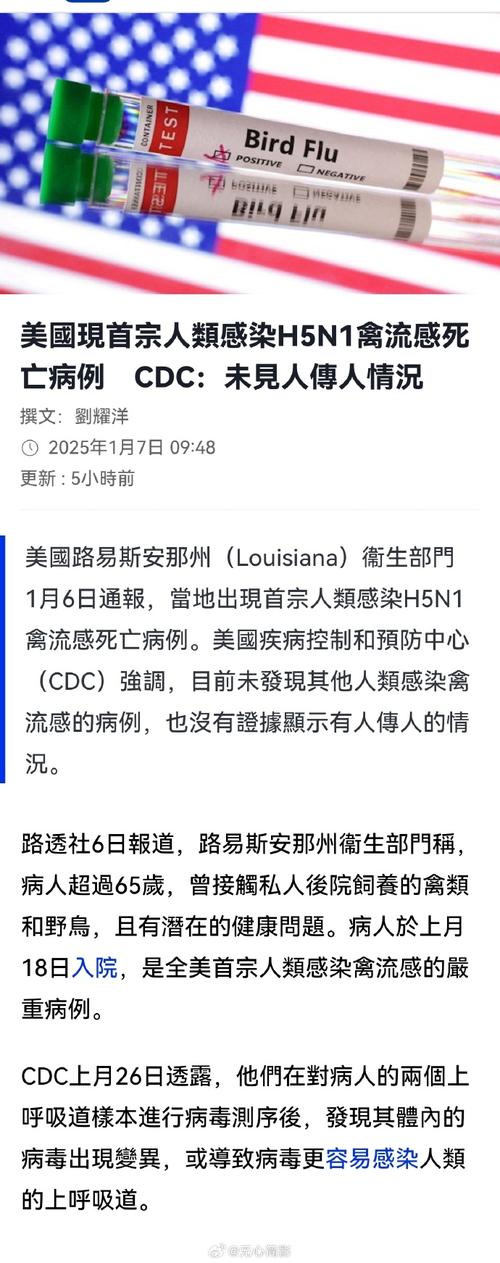 美国出现首例禽流感重症病例