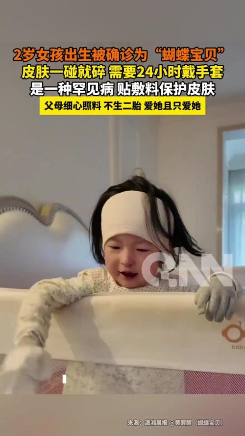 罕见!年仅2岁,确诊!父母为此吵翻……