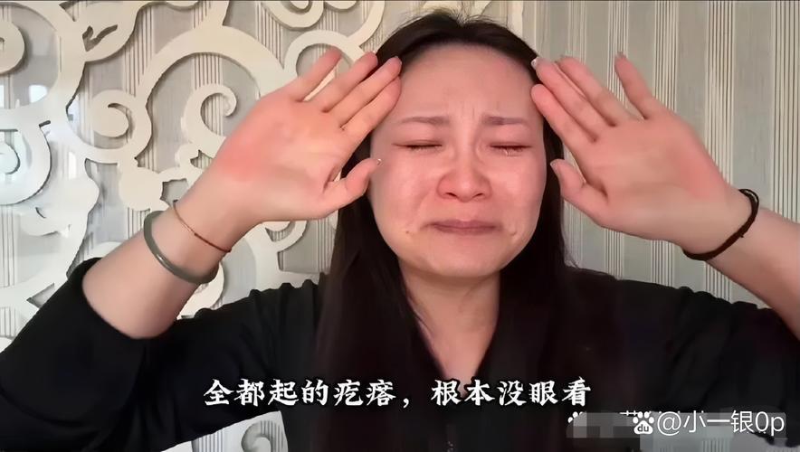 针头断进皮肤里,找不到了?杭州女子吓惨:再也不敢了